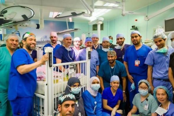 نجاح فصل التوأم السيامي اليمني "يوسف وياسين" الملتصقين بالرأس في عملية استغرقت 15 ساعة