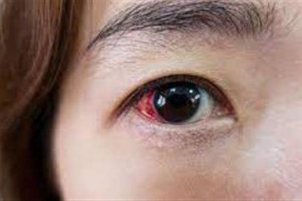 ما هي أسباب وأعراض المرض المسبب للعمى؟